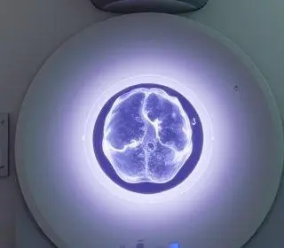 Carreta da Mamografia